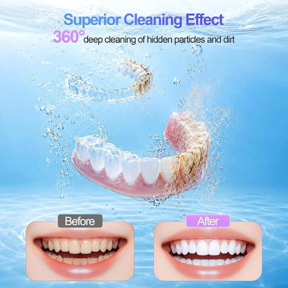 Ultrasonic Retainer Cleaner